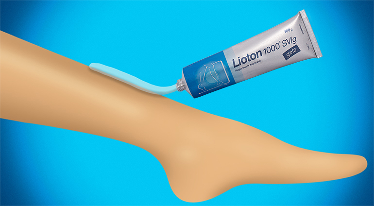 Application of Lioton 1000 gel on heavy leg